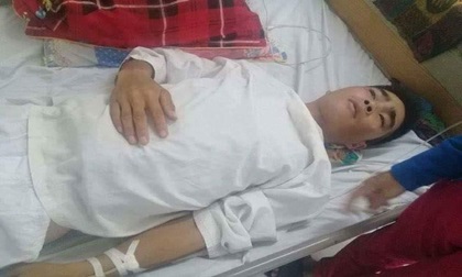 Sửa mái nhà cho bố mẹ chống bão, chàng trai bị ngã chấn thương sọ não, nguy cơ liệt