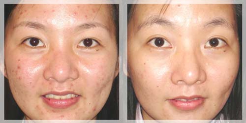 1 qua chanh –  5 cong dung lam dep hieu qua hon ca my pham tien trieu - 3