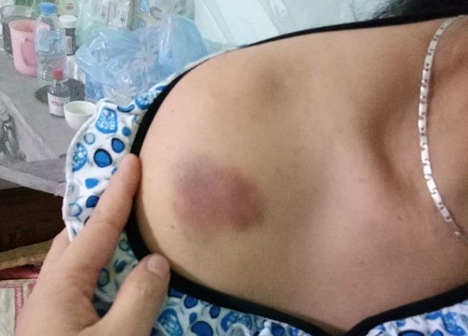 Trần tình của 2 người phụ nữ bị đánh bầm dập vì nghi bắt cóc trẻ con - 3
