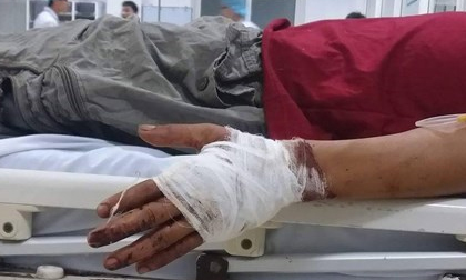 Tranh giành khách du lịch, một chủ thuyền bị chém lìa tay