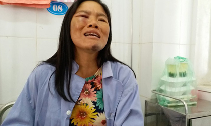 Gia cảnh kiệt quệ của người phụ nữ bán tăm bị đánh oan đến nhập viện vì nghi bắt cóc