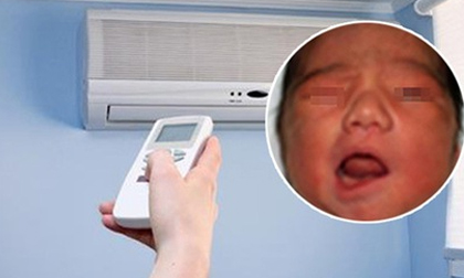 Bé trai 2 tuổi bị liệt mặt khi ngủ dậy vì nằm điều hòa cả đêm