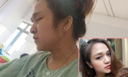 Vợ đau đẻ, chồng hớn hở chụp ảnh để 'cho em thấy hôm nay em kinh như thế nào'