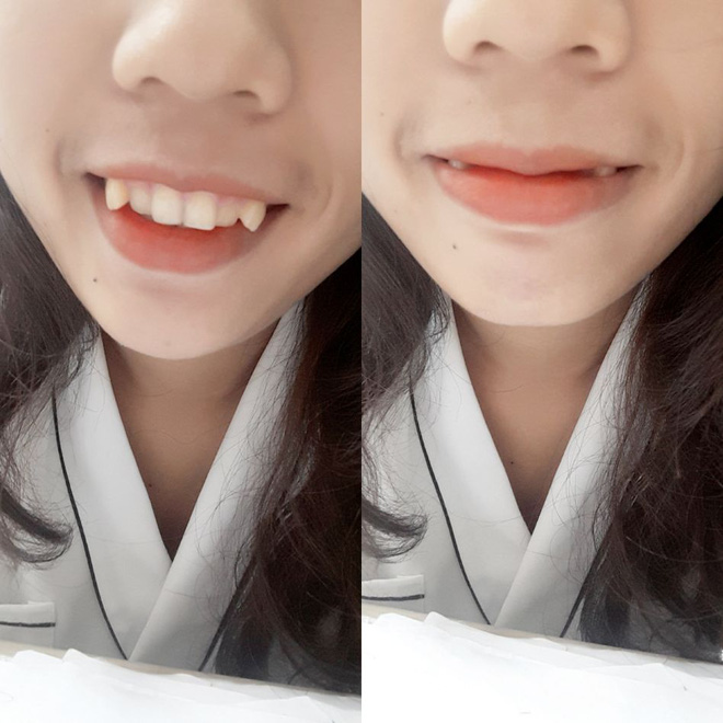 Đến chơi nhà người yêu, cô gái phát điên vì mẹ bạn trai chê răng khấp khểnh như ma cà rồng - Ảnh 5. Đến chơi nhà người yêu, cô gái phát điên vì mẹ bạn trai chê răng khấp khểnh như ma cà rồng - Ảnh 5.