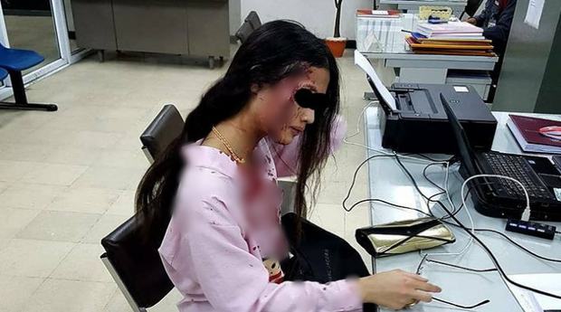 Yêu nhầm người, cô gái bị bạn trai đánh đập dã man dù đang mang bầu 2 tháng - Ảnh 1.