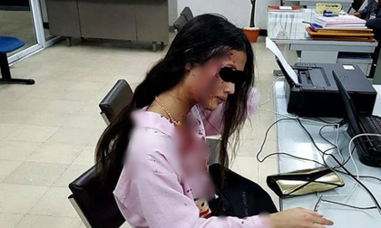 Yêu nhầm người, cô gái bị bạn trai đánh đập dã man dù đang mang bầu 2 tháng