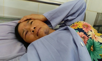 2 người phụ nữ bị đánh vì nghi bắt cóc trẻ con: “Vợ tôi liên tục hoảng loạn, gào thét lúc nửa đêm”