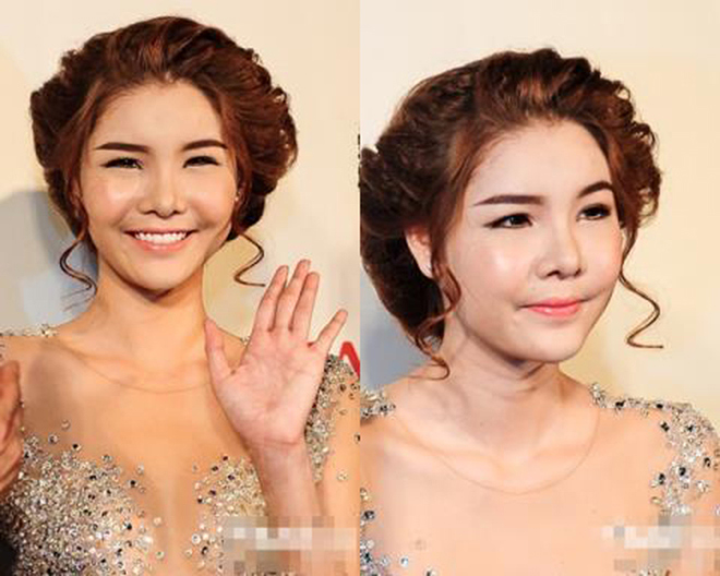 sao viet phau thuat tham my - hanh trinh