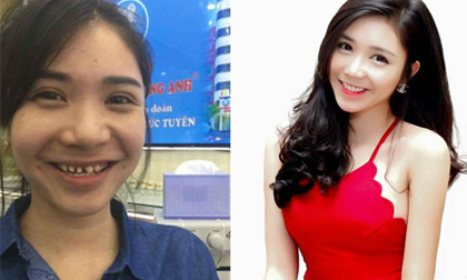 Thanh Bi: 'Hình ảnh trên mạng xã hội đã bị sửa xấu đi'