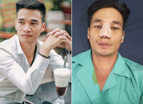 Lệ Rơi, Tùng Sơn và Thúy Vi 