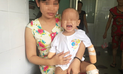TP.HCM: Xót xa bé gái 2 tuổi bị đoạn tứ chi vì viêm não mô cầu