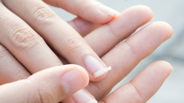 7 dấu hiệu bất thường mà nhiều người chủ quan bỏ qua nên gây không ít rắc rối cho sức khỏe - Ảnh 7.