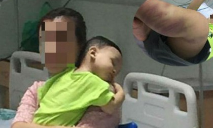 Sự thật về người mẹ của bé trai 14 tháng tuổi bị hành hung, bỏ rơi tại bệnh viện