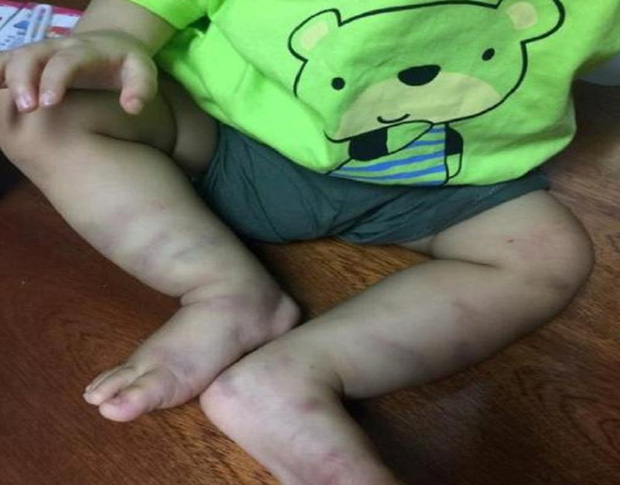 Mẹ của bé trai 1 tuổi bị bạo hành: Không muốn đưa con vào trại nếu phải thi hành án - Ảnh 2. Mẹ của bé trai 1 tuổi bị bạo hành: Không muốn đưa con vào trại nếu phải thi hành án - Ảnh 2.