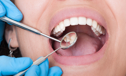 Thấy miệng có dấu hiệu này hãy tới bệnh viện ngay kẻo hối hận chẳng kịp