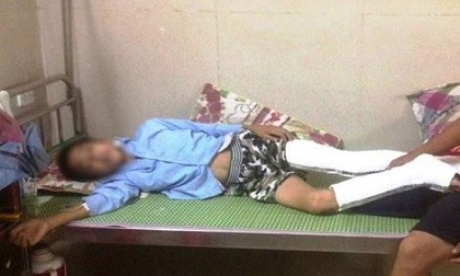 Bị cô giáo thu điện thoại, nam sinh lớp 9 nhảy từ tầng 3 xuống đất, bị gãy và vỡ xương cả hai chân