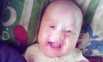 Hà Giang: Bé trai hơn 2 tháng tuổi tử vong bất thường sau điều trị vàng da