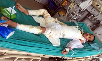Cháy xưởng bánh kẹo 8 người tử vong: Hai thiếu niên đã tỉnh lại