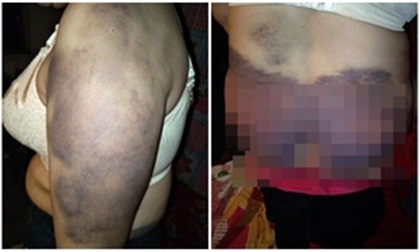 Người phụ nữ bị chồng bạo hành suốt 20 năm, biến thành 'nô lệ' phục vụ cho nhân tình của chồng