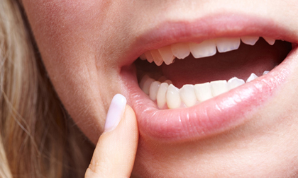 Dấu hiệu không ngờ cảnh báo bạn đang mắc ung thư miệng, cần tới bệnh viện ngay