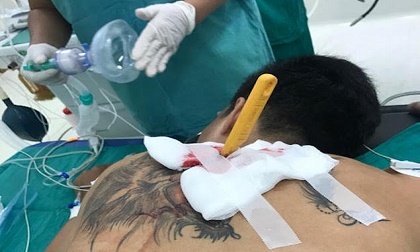Nam thanh niên xăm trổ bị bạn gái cầm dao đâm lút cán