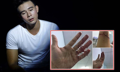 Đông Hùng nhắn tin với ca sĩ Pha Lê sau khi bị chủ nợ chém