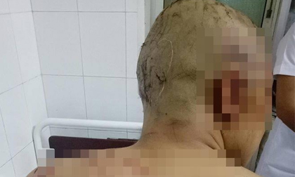Bị chém hàng chục nhát, thanh niên giả chết thoát thân