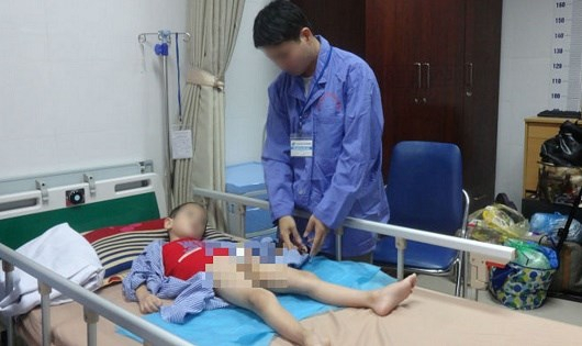 Trẻ bị sủi mào gà bị tổn thất cả về mặt sức khỏe lẫn tinh thần.