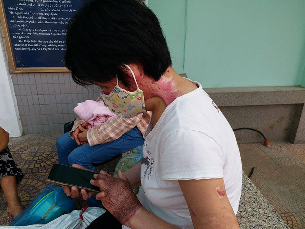 Gặp lại người phụ nữ từng bị chồng nhốt, tẩm xăng thiêu sống: Tôi không còn oán hận, chỉ mong có ngày đoàn tụ với con - Ảnh 5.
