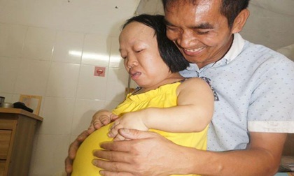 Bất chấp nguy hiểm, người phụ nữ cao 91cm như đứa trẻ lên ba mang bầu vượt mặt