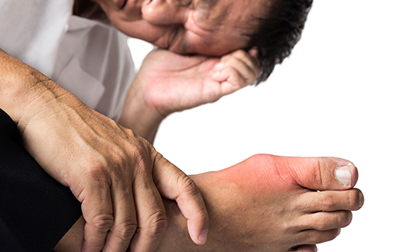 Bệnh gout nặng đến mấy áp dụng bài thuốc dưới đây hiệu quả rõ rệt sau vài ngày