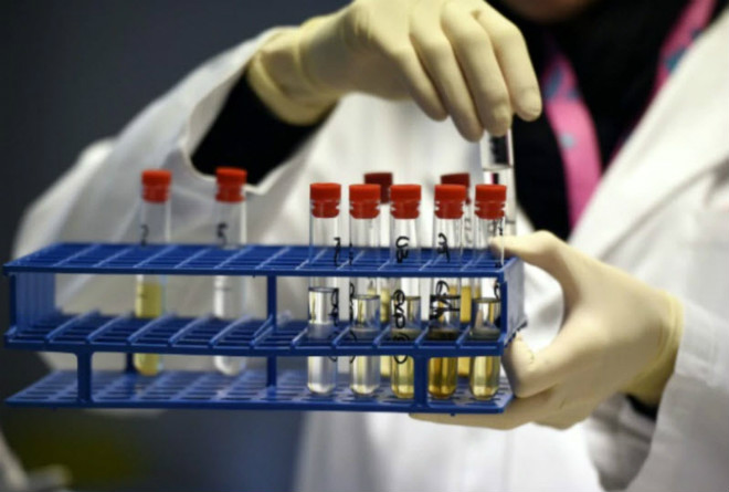 Chấn động hậu SEA Games: 3 VĐV dính doping, tóm gọn 1 HCV dùng chất cấm