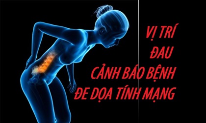 Nếu đau ở vị trí này hãy đi khám ngay vì đây là dấu hiệu báo bệnh nguy hiểm khôn lường