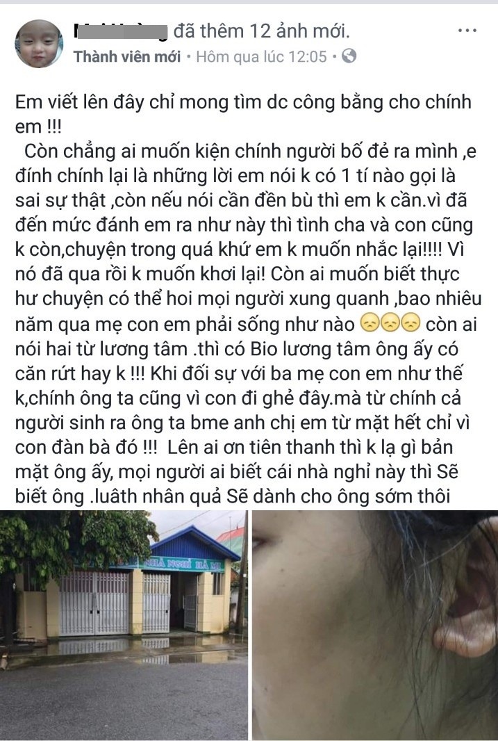 Xôn xao thông tin bố đẻ dùng gạch đánh con gái nhập viện - Ảnh 2.