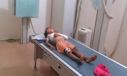 Bé lớp 1 bị cửa sắt đè gãy xương, hiệu trưởng bảo không có trách nhiệm