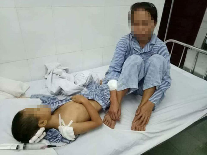 Chồng say rượu chém vợ con dã man - 1