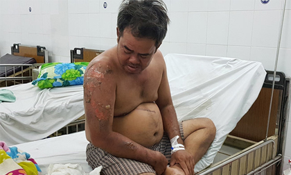 Con trai lao vào biển lửa chục lần cứu mẹ nhưng bất thành