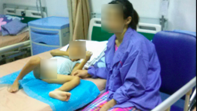 80 tre bi lay sui mao ga do nong tach bao quy dau o hung yen bay gio ra sao? - 1