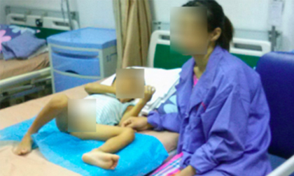80 trẻ bị lây sùi mào gà do nong tách bao quy đầu ở Hưng Yên bây giờ ra sao?