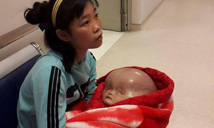 Người mẹ bị tố không đồng ý đưa con bị não úng thủy sang Singapore chữa trị lên tiếng