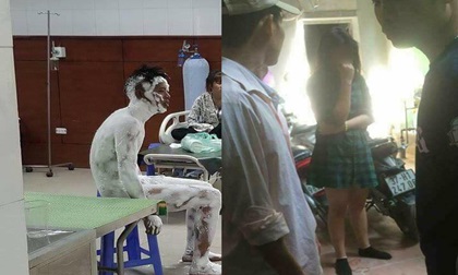Vụ nam thanh niên bỏng toàn thân: Tẩm xăng tự thiêu do người yêu đòi chia tay