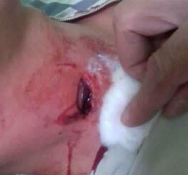 Nam thanh nien bi dan gam trung co khi dang nam trong nha hinh anh 1