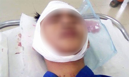 Nhóm thanh niên thấy người là chém khiến người dân Đồng Nai hoang mang