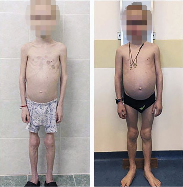 be trai 11 tuoi chi nang 12kg vi am muu khong the dung thu cua nguoi me nuoi - 1