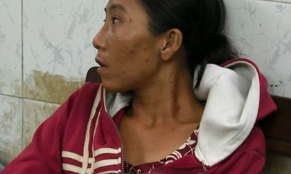 “Chăn dắt” trẻ trước cổng viện lấy tiền tiêm chích: Người mẹ có bị tước quyền nuôi con?