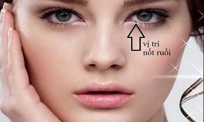Khám phá ý nghĩa đặc biệt của nốt ruồi mọc trong mắt