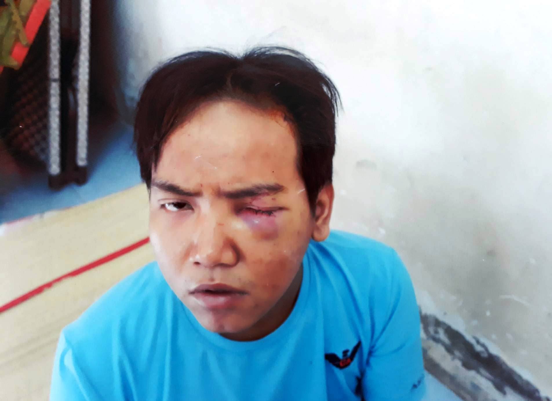 Lời khai không ngờ của bảo vệ dân phố sát hại bé trai 6 tuổi ở SG - 1