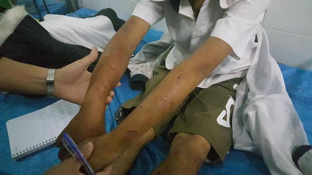 be trai 11 tuoi bi bo danh da chan thuong: