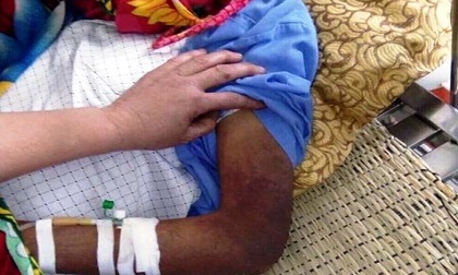 Nghệ An: Phẫn nộ con trai đánh cha gãy xương sườn