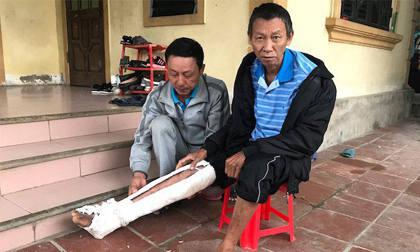 Con trai đánh bố gãy xương, bầm tím khắp người: 'Nó còn mang xăng định đốt cả bố'